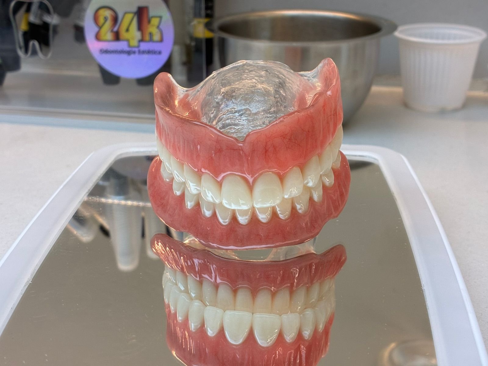 Resultado final da Prótese Overdenture