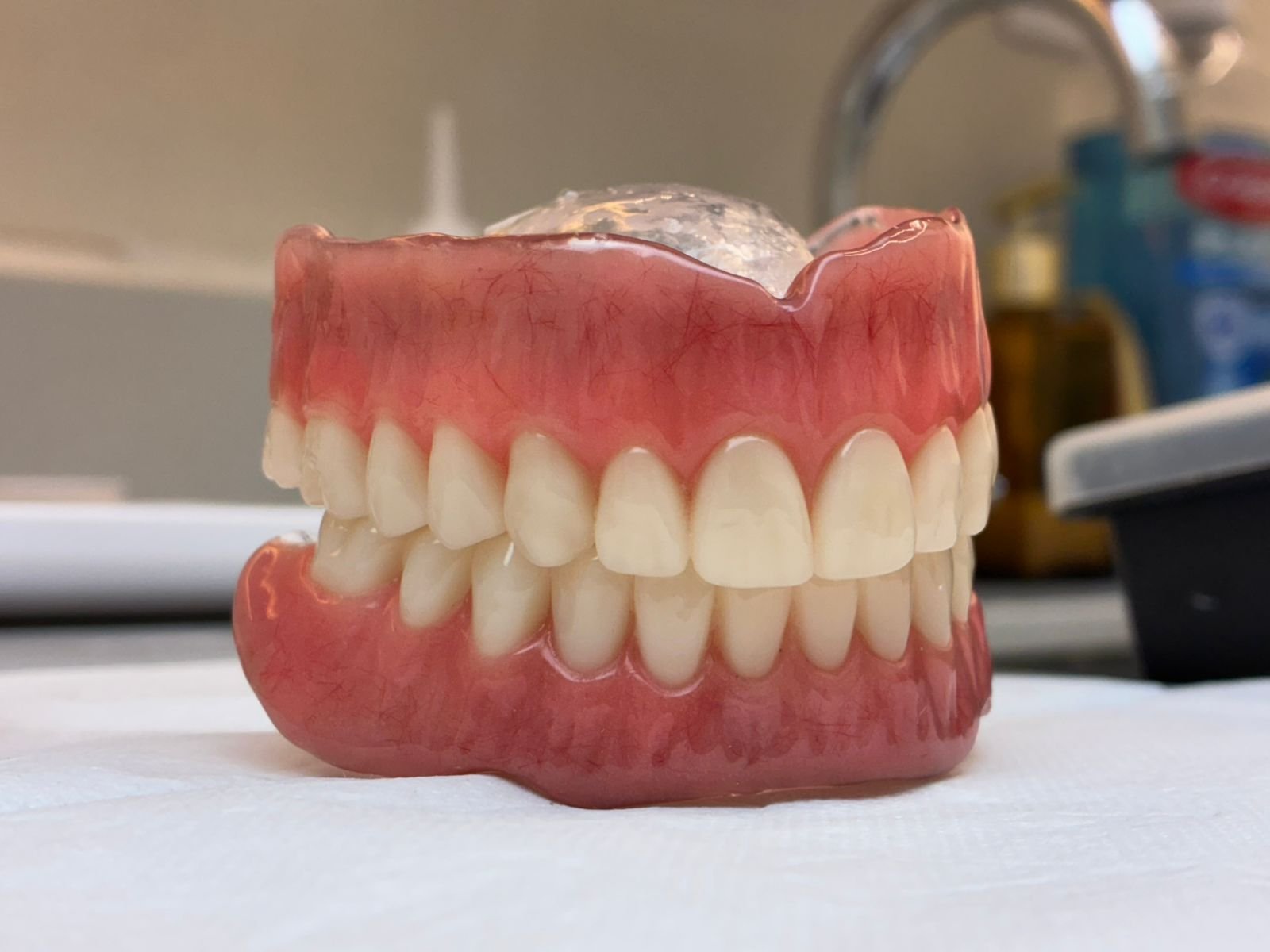 Processo de colocação da Prótese Overdenture